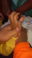Bombeiros atendem criança com rolamento de aço preso no dedo