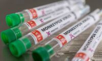 Saúde Brasil recebe o primeiro lote de vacinas contra a varíola dos macacos
